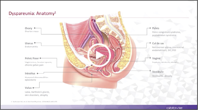Sexual response cycle and dysfunction in endometriosis anatomical illustration