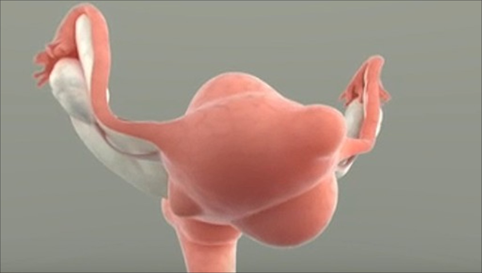 The visual rotates around the uterus.