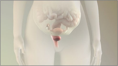 https://www.digitalobgyn.com/content/dam/Womens-Health-HCP/Images/pdf-imgs/symptoms-a-and-b-transcript/severe-dysmenorrhea-and-non-menstrual-pelvic-pain-img1.jpg