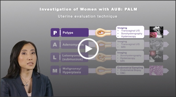 Dr Jin Hee Kim discussing PALM in investigating abnormal uterine bleeding